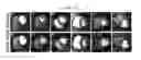 Fig. 20 - Systems and methods for myocardial perfusion MRI without the need for ECG gating and additional systems and methods for improved cardiac imaging