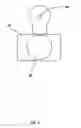 Fig. 04 - Light diffuser adapter