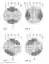 Fig. 06 - Illumination optical unit for EUV projection lithography