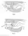 Fig. 04 - Method and device for guiding an aircraft during a low level flight