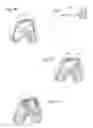 Fig. 04 - System and method for determining an optimal type and position of an implant