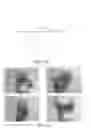 Fig. 07 - Performing hand gesture recognition using 2D image data