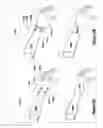Fig. 16 - Somatic, auditory and cochlear communication system and method