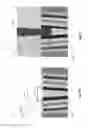 Fig. 10 - Trench multilevel contact to a 3D memory array and method of making thereof