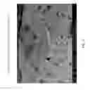 Fig. 08 - METHOD OF MAKING A RUBBER-CONTAINING POLYOLEFIN SEPARATOR