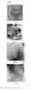 Fig. 07 - MICRON SIZED ANODE ACTIVE MATERIAL CONTAINING TITANIUM DIOXIDE NANOPARTICLES AND METHOD FOR THE PREPARATION THEREOF