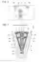 Fig. 06 - ROTOR OF ROTARY ELECTRIC MACHINE