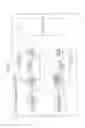 Fig. 05 - Image signal decoding apparatus and image signal decoding method