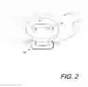 Fig. 03 - Button repair system and method