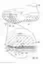 Fig. 12 - Sole system having movable protruding members