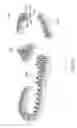 Fig. 20 - Sole system having movable protruding members