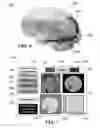 Fig. 07 - METHOD AND SYSTEM FOR QUANTITATIVE ASSESSMENT OF VERBAL RECOGNITION MEMORY