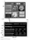 Fig. 15 - METHOD AND SYSTEM FOR QUANTITATIVE ASSESSMENT OF VERBAL RECOGNITION MEMORY