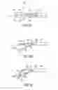 Fig. 06 - Methods and devices for creating tissue plications