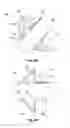 Fig. 06 - CANNULA