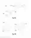 Fig. 07 - CANNULA