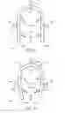 Fig. 02 - BONE TISSUE FIXATION DEVICE AND METHOD