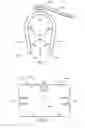 Fig. 07 - BONE TISSUE FIXATION DEVICE AND METHOD