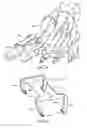 Fig. 18 - BONE TISSUE FIXATION DEVICE AND METHOD