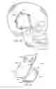 Fig. 20 - BONE TISSUE FIXATION DEVICE AND METHOD