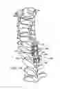 Fig. 21 - BONE TISSUE FIXATION DEVICE AND METHOD