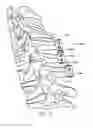 Fig. 22 - BONE TISSUE FIXATION DEVICE AND METHOD