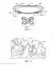 Fig. 29 - BONE TISSUE FIXATION DEVICE AND METHOD