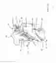 Fig. 05 - THREADED BONE FILLING MATERIAL PLUNGER
