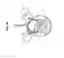 Fig. 13 - THREADED BONE FILLING MATERIAL PLUNGER