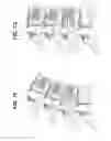 Fig. 20 - THREADED BONE FILLING MATERIAL PLUNGER