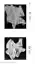 Fig. 06 - Multi-pole synchronous pulmonary artery radiofrequency ablation catheter