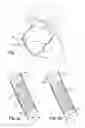 Fig. 02 - Medical Device for Revascularization of Vascular Occlusion and Method for Using Same