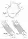 Fig. 06 - Medical Device for Revascularization of Vascular Occlusion and Method for Using Same