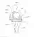 Fig. 02 - DEVICE FOR POSITIONING JOINT LINE FOR REVISION TOTAL KNEE ARTHROPLASTY