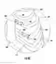 Fig. 07 - DEVICE AND METHOD OF USE FOR A HORIZONTAL THORACIC EXPANDER