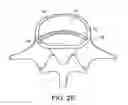 Fig. 07 - In-situ formed intervertebral fusion device and method