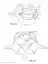 Fig. 08 - In-situ formed intervertebral fusion device and method