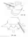 Fig. 09 - In-situ formed intervertebral fusion device and method