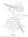 Fig. 10 - In-situ formed intervertebral fusion device and method