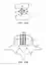 Fig. 20 - In-situ formed intervertebral fusion device and method