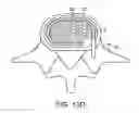 Fig. 24 - In-situ formed intervertebral fusion device and method