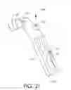 Fig. 22 - Adjustable implant and method of use