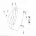 Fig. 49 - Adjustable implant and method of use