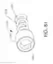 Fig. 85 - Adjustable implant and method of use