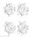 Fig. 89 - Adjustable implant and method of use