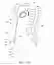 Fig. 99 - Adjustable implant and method of use