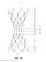 Fig. 06 - Bypass device, support frame for bypass device, and method