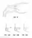 Fig. 07 - Bypass device, support frame for bypass device, and method