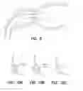 Fig. 07 - BYPASS DEVICE, SUPPORT FRAME FOR BYPASS DEVICE, AND METHOD