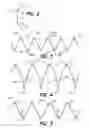 Fig. 03 - BYPASS DEVICE, SUPPORT FRAME FOR BYPASS DEVICE, AND METHOD